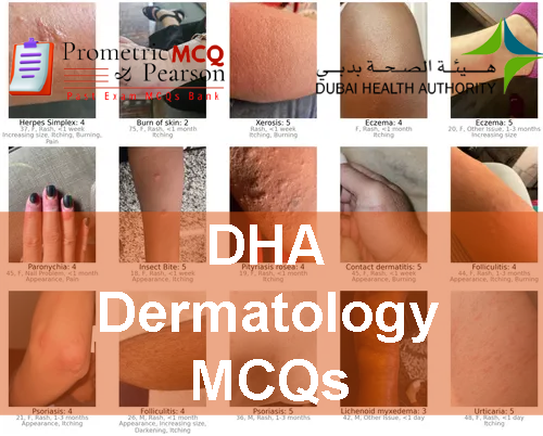 dermatology skin conditions advertising DHA Dermatology Prometric Licensing Exam MCQs
