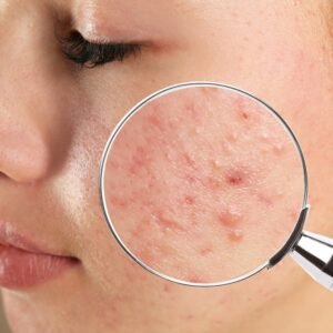 DHA Dermatology MCQs