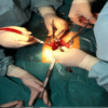 DHA Urology MCQs 2